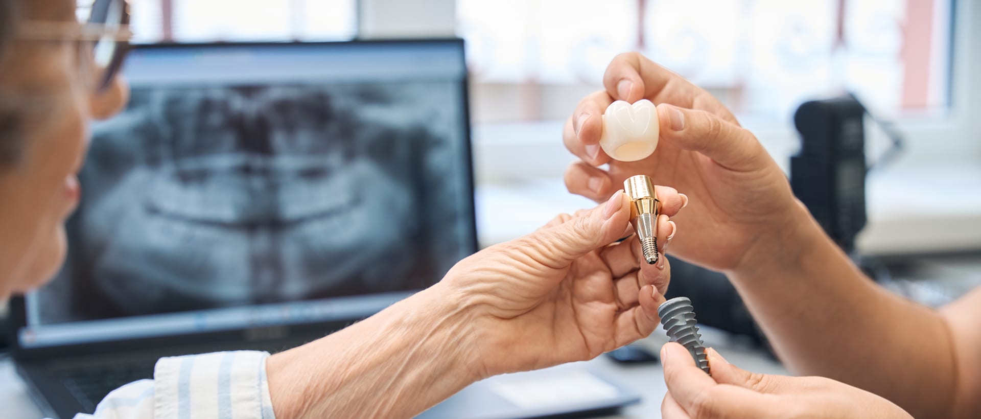 Dentist showing a patient a dental implant model