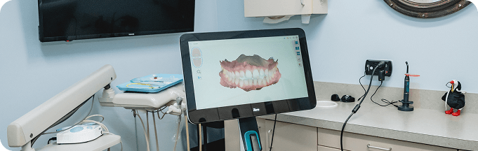 iTero digital scanner showing a 3D scan of teeth