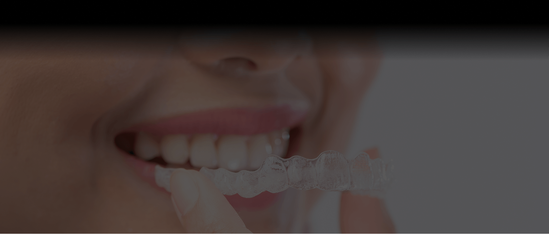 Patient holding a clear dental aligner
